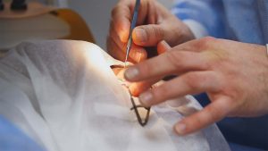 Surgical-Treatments Surgical-Treatments